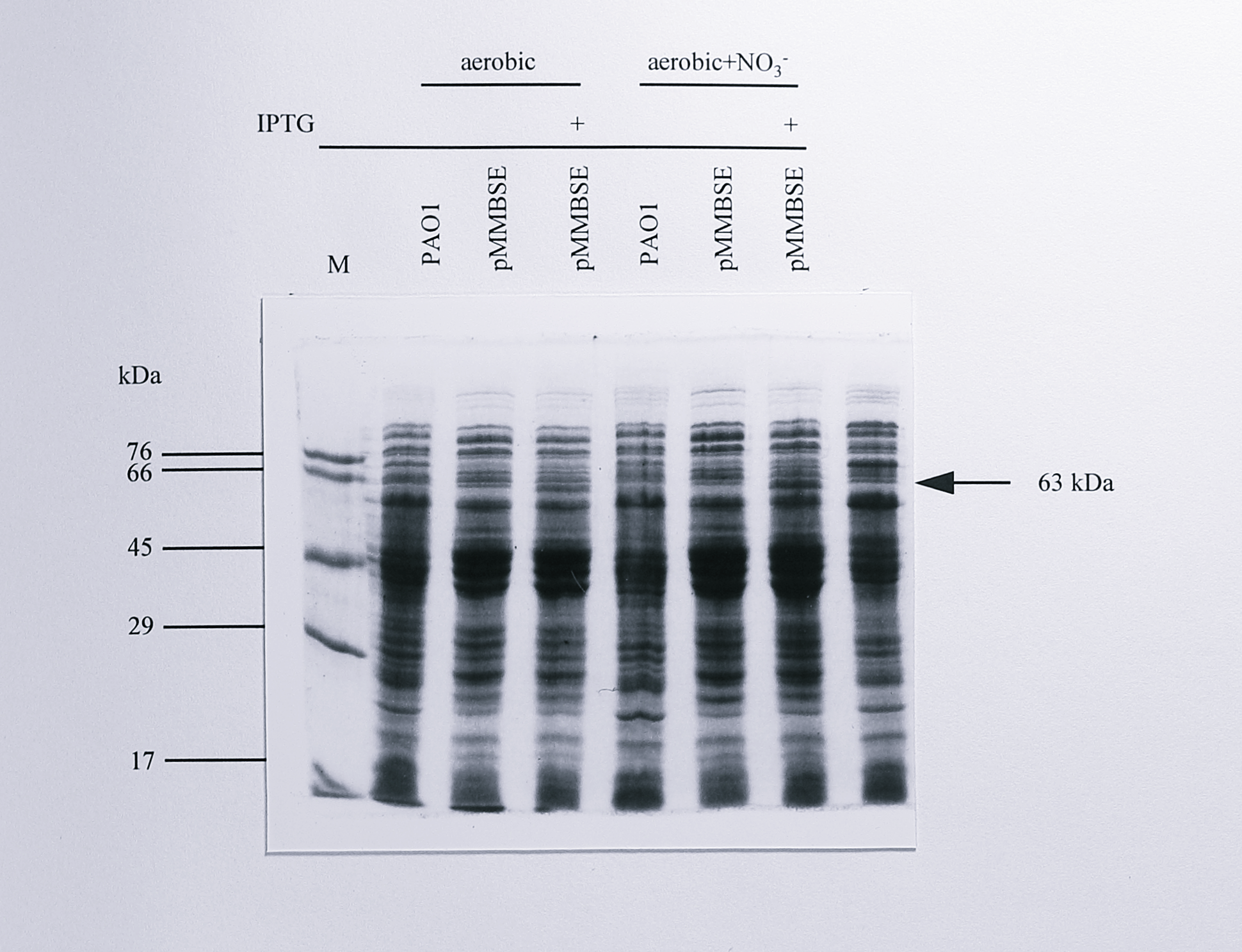 Comparison of the protein content of _Ps. aeruginosa_ with that of _Ps. aeruginosa_ [pMMBSE] under different growth conditions. 40 $\mu$g of protein from the soluble extracts indicated was separated by electrophoresis on an 8% SDS-PAGE gel and stained for protein using Coomassie Brilliant Blue R250. The lane labelled M contained molecular weight markers, the sizes of which are indicated at the left of the gel. A 63 kDa band, corresponding to expressed _T. pantotropha_ cytochrome _cd_$_1$ is visible in lanes 4 and 7.
