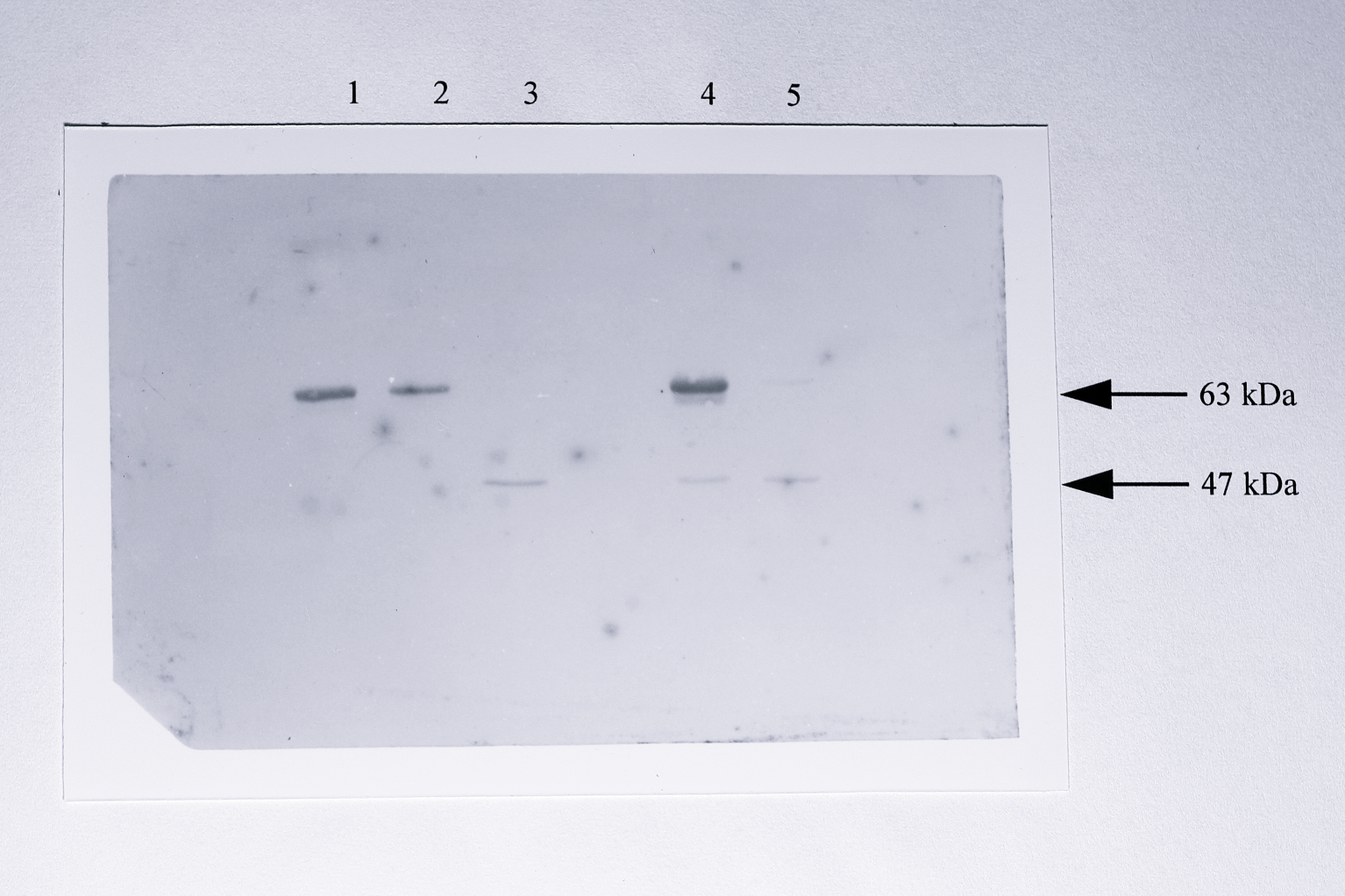 Western blot of total soluble extracts from wild-type _T. pantotropha_, _T. pantotropha_ K7, _T. pantotropha_ $\Delta7$, T. pantotropha $\Delta7$ [pMMBSEK] and _T. pantotropha_ $\Delta7$ [pMMBY25F] using antibody raised against _P. denitrificans_ cytochrome _cd_$_1$. 40 $\mu$g of protein was loaded in each lane and the samples were separated in a 6% acrylamide SDS-PAGE gel, transferred to nitrocellulose by semi-dry electroblotting and probed using the anti-cytochrome _cd_$_1$ antibody. The 63 kDa band (mature cytochrome _cd_$_1$) and 47 kDa band (truncated cytochrome _cd_$_1$) are indicated by the upper and lower arrows respectively. Lanes: 1, _T. pantotropha_ wild-type, 2, _T. pantotropha_ K7, 3, _T. pantotropha_ $\Delta7$, 4, _T. pantotropha_ $\Delta7$ [pMMBSEK], 5, _T. pantotropha_ $\Delta7$ [pMMBY25F].
