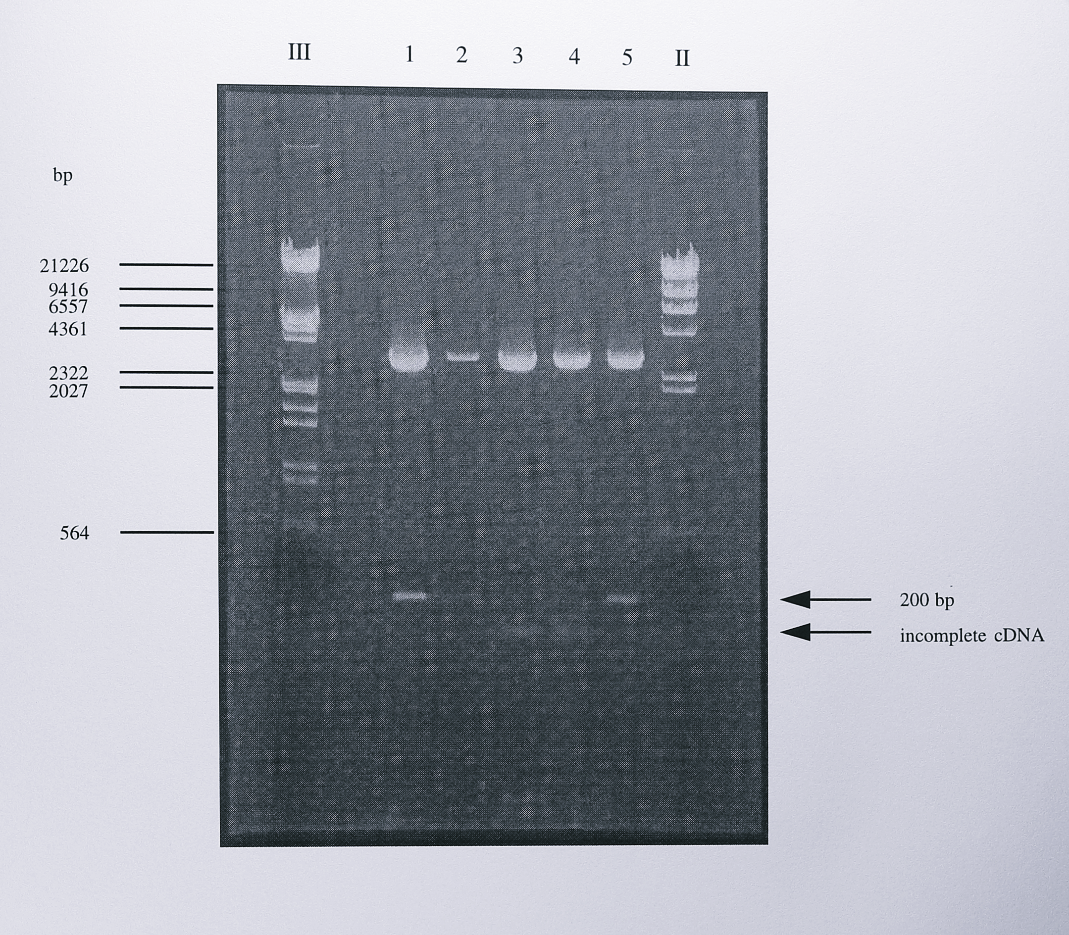 Restriction digest analysis of the cloned PCR products generated from _nirS_ mRNA by 5'-RACE. The 200 bp PCR product generated by PCR using the primers Q1F and 284R (Figure 7.8) was cloned into the T-vector pGEM-T. Following blue-white selection, positive clones were digested using the enzymes _SphI_ and _NdeI_. These enzymes cut once each side of the multiple cloning site but not in the _nirS_ gene sequence and therefore were a good screen for the presence of a cloned insert. Three of the clones (lanes 1, 2 and 5) contained the expected 200 bp insert. the other clones (lanes 3 and 4) contained a smaller insert. Sequencing of the latter clones showed that the smaller insert originated in the coding region of the _nirS_ gene and therefore resulted for incomplete cDNA synthesis during 5'-RACE. The lanes labelled III and II contained DNA size standards, some of which are indicated to of the gel.